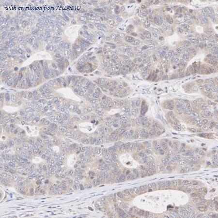 HUABIO ET7106-72 image 3