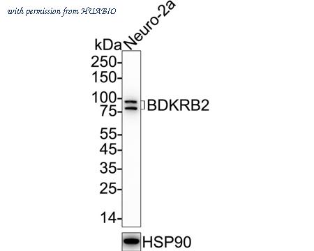 HUABIO ET7106-74 image 1