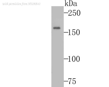 HUABIO ET7106-75 image 1