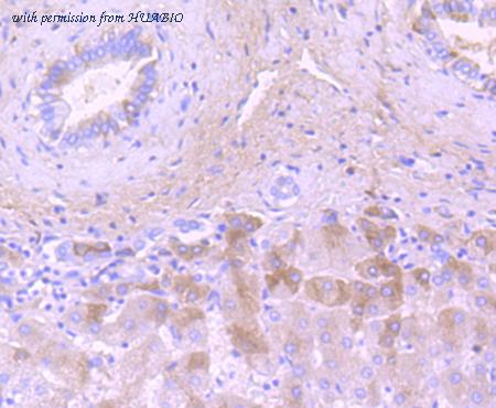 HUABIO ET7106-75 image 2