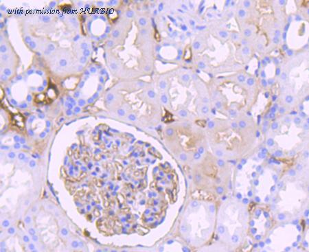 HUABIO ET7106-75 image 3