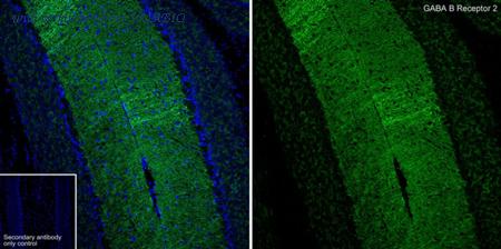 HUABIO ET7106-88 image 1