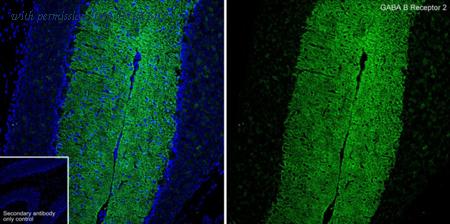 HUABIO ET7106-88 image 2