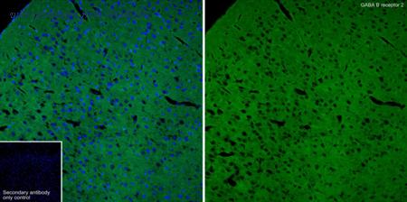 HUABIO ET7106-88 image 3