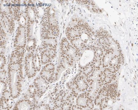 HUABIO ET7106-92 image 2