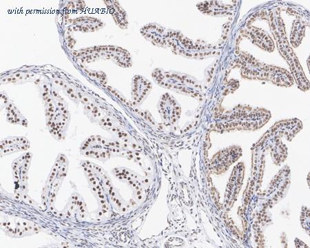 HUABIO ET7106-92 image 3