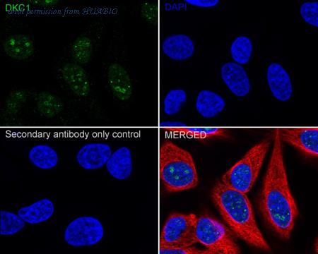 HUABIO ET7106-93 image 2