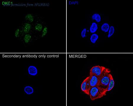 HUABIO ET7106-93 image 3
