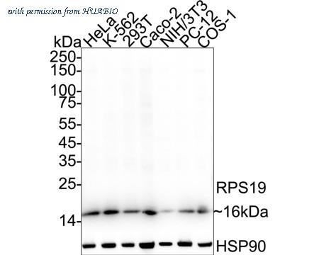 HUABIO ET7106-94 image 1
