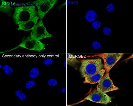 HUABIO ET7106-94 image 3