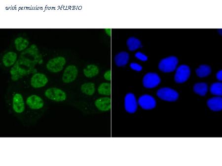 HUABIO ET7106-95 image 2