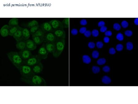 HUABIO ET7106-95 image 3