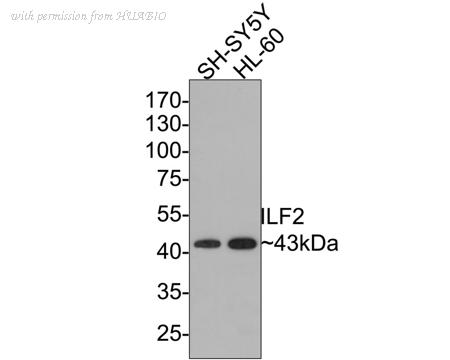 HUABIO ET7106-96 image 1