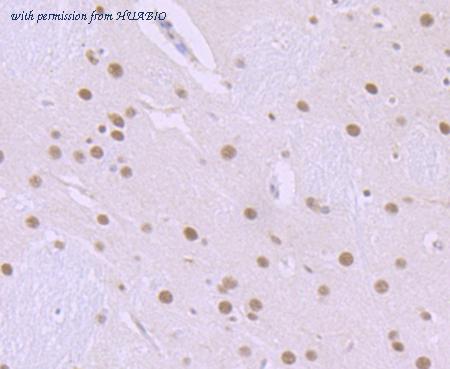 HUABIO ET7106-96 image 2