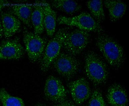 HUABIO ET7106-98 image 3