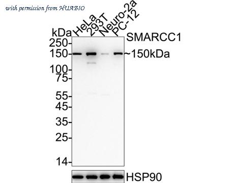 HUABIO ET7107-12 image 1