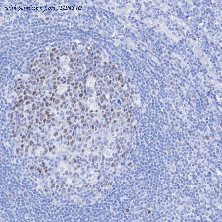 HUABIO ET7107-14 image 2