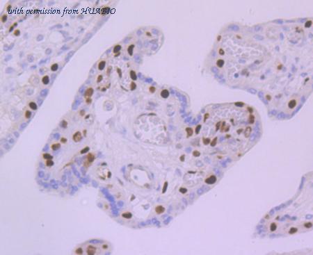 HUABIO ET7107-15 image 3