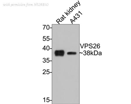 HUABIO ET7107-21 image 1