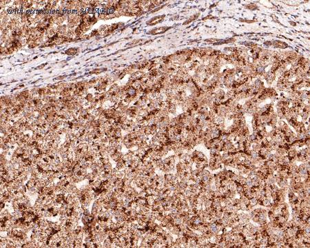 HUABIO ET7107-26 image 2