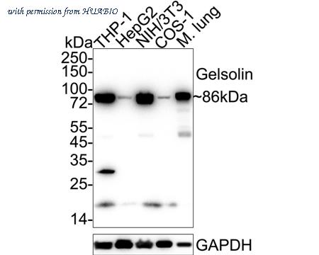 HUABIO ET7107-45 image 1
