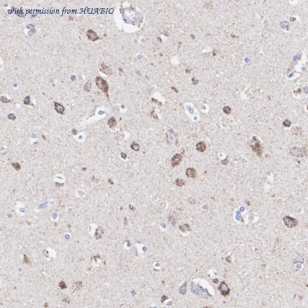 HUABIO ET7107-46 image 2