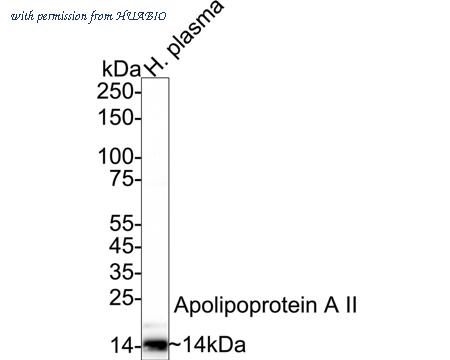 HUABIO ET7107-47 image 1