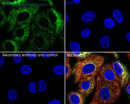 HUABIO ET7107-47 image 2