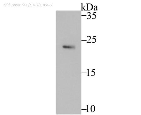 HUABIO ET7107-50 image 1
