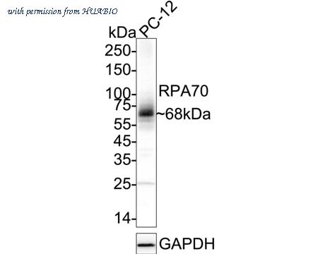 HUABIO ET7107-51 image 2