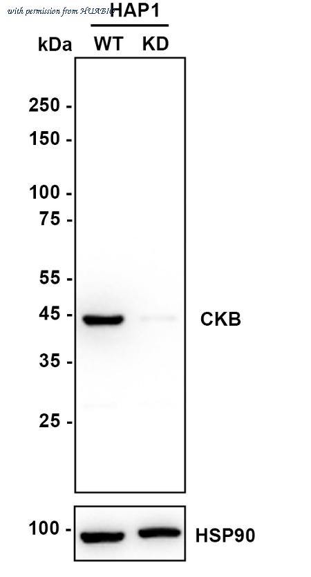 HUABIO ET7107-52 image 2