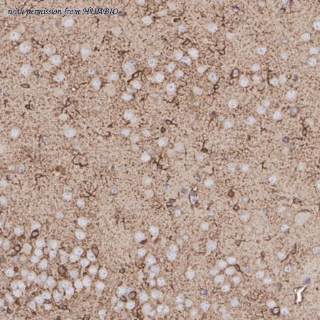 HUABIO ET7107-52 image 3