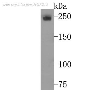 HUABIO ET7107-58 image 1