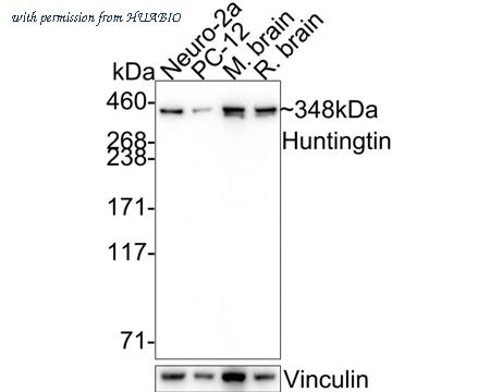 HUABIO ET7107-60 image 1