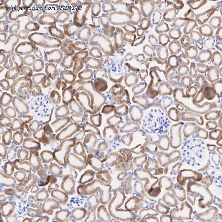 HUABIO ET7107-61 image 3