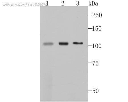 HUABIO ET7107-66 image 1