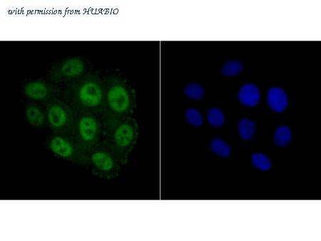 HUABIO ET7107-66 image 3