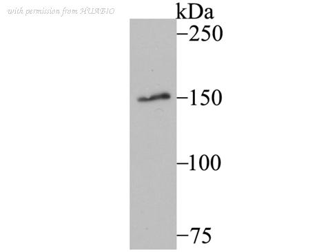 HUABIO ET7107-67 image 1