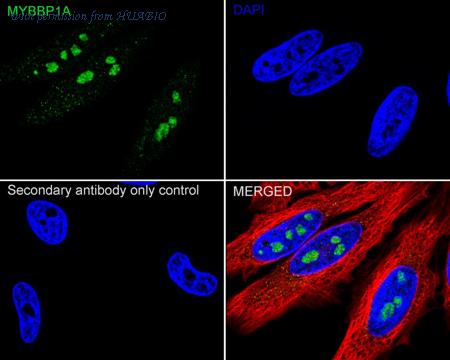 HUABIO ET7107-67 image 2