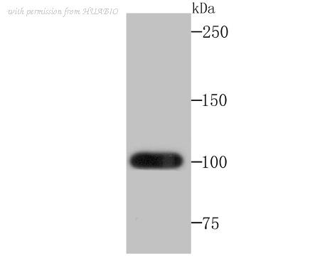 HUABIO ET7107-68 image 1