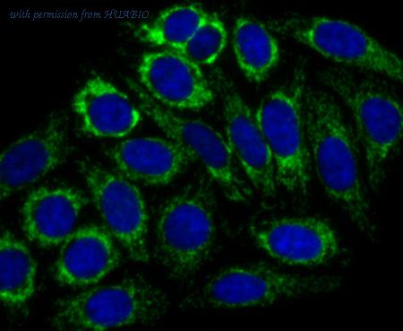 HUABIO ET7107-69 image 2