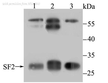 HUABIO ET7107-70 image 1