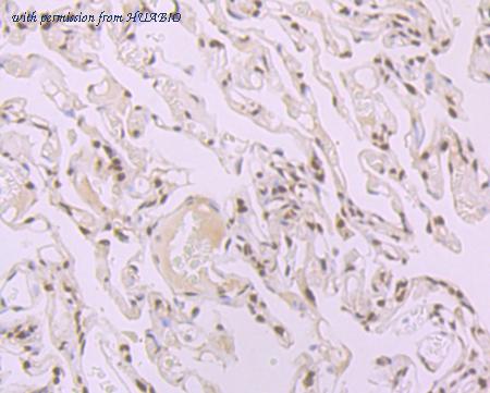 HUABIO ET7107-70 image 3