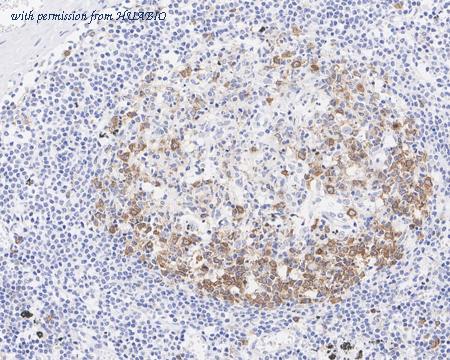 HUABIO ET7107-72 image 3