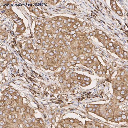 HUABIO ET7107-75 image 2