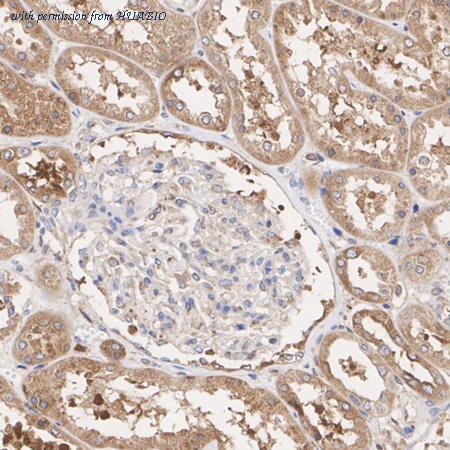 HUABIO ET7107-75 image 3