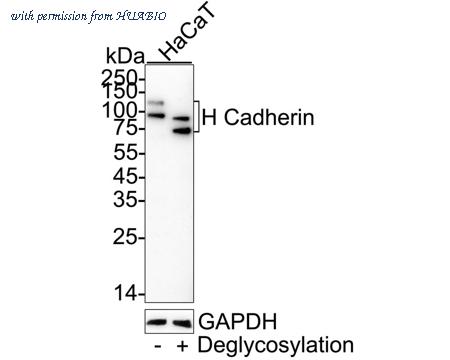 HUABIO ET7107-76 image 1