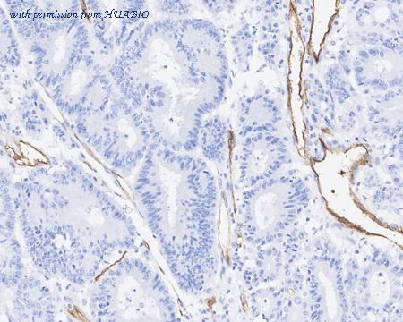 HUABIO ET7107-76 image 2