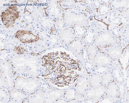 HUABIO ET7107-76 image 3