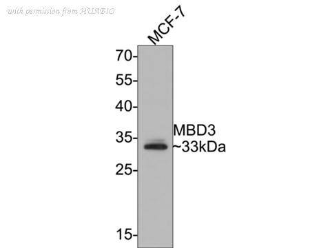 HUABIO ET7107-78 image 1